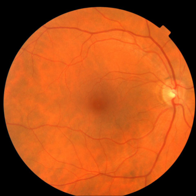 AI của Google có
thể chẩn đoán tình trạng tim
mạch bằng cách quét... mắt của bệnh nhân