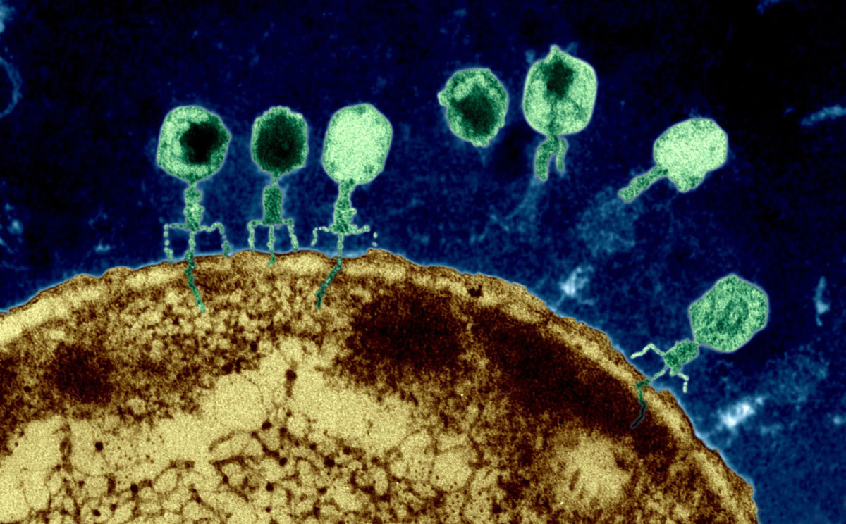 Virus có thể lây nhiễm và giết chết siêu vi khuẩn, tại sao không dùng chúng thay cho thuốc kháng sinh đã mất tác dụng?