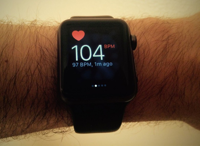 Apple đang tiến hành
phát triển một con chip dành riêng cho việc phân tích dữ
liệu sức khỏe trên Apple Watch
