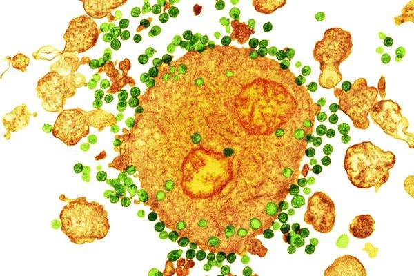 Đột phá: Bệnh nhân
nhiễm HIV thứ hai trên thế giới được chữa khỏi bằng liệu
pháp tế bào gốc
