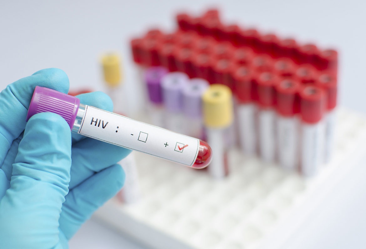 Nghiên cứu xác nhận
tỷ lệ truyền nhiễm 0% ở bệnh nhân uống thuốc ARV - Hồi kết
của HIV/AIDS đã đến?