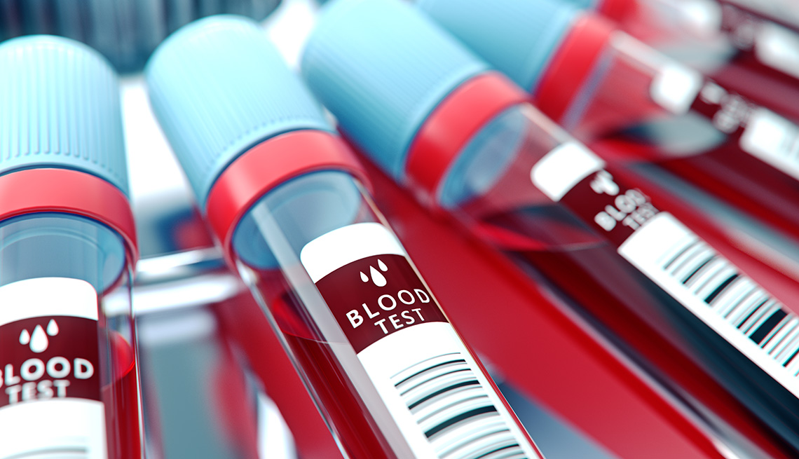 Xét nghiệm máu có thể
dự đoán trước cái chết, độ chính xác tới 83%