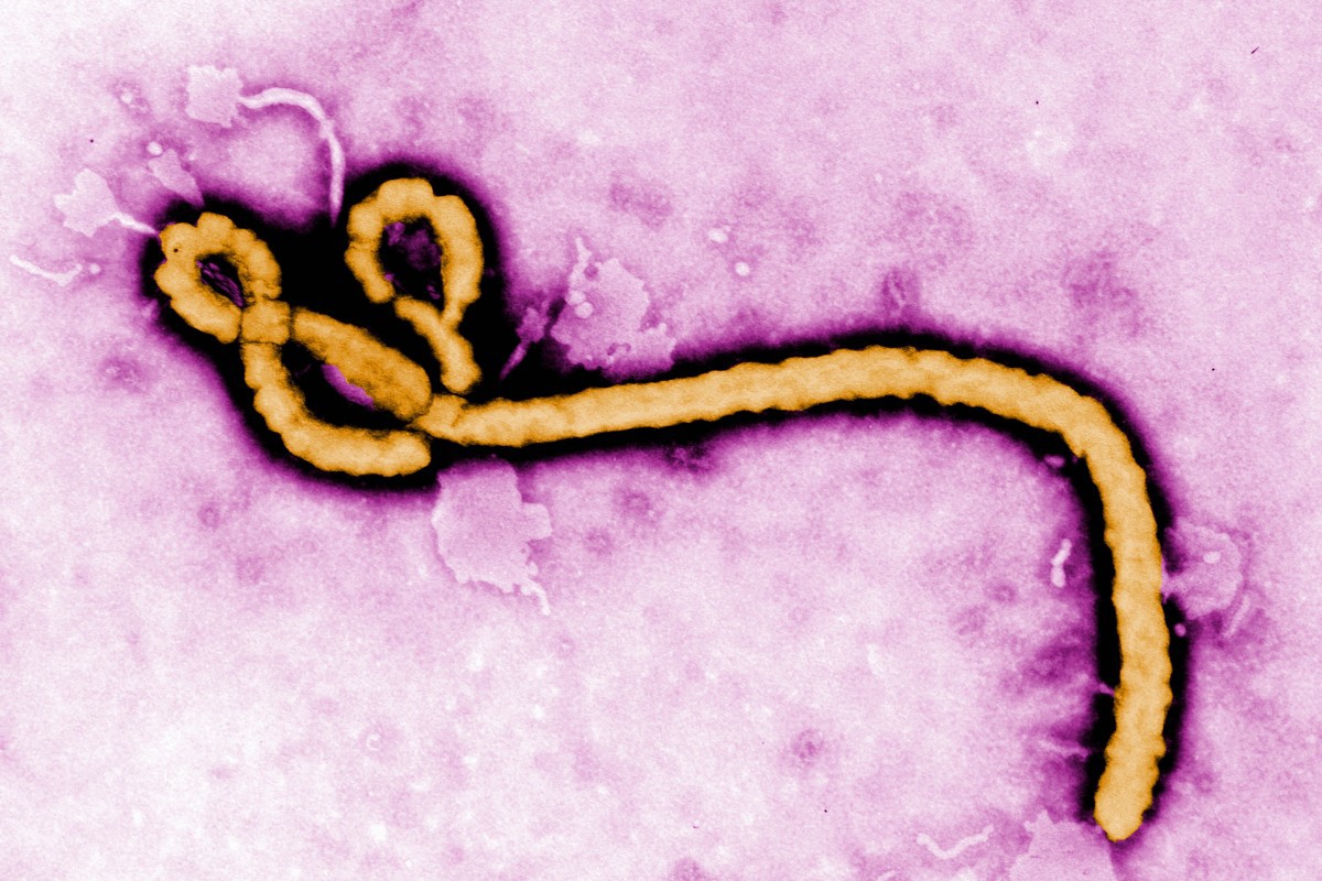 Nhật Bản vừa nhập
khẩu virus Ebola và 4 mầm bệnh sốt xuất huyết nguy hiểm
nhất