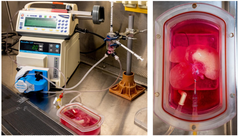 Những lá gan được in
3D sinh học sẽ tạo ra cuộc cách mạng trong lĩnh vực cấy ghép
nội tạng