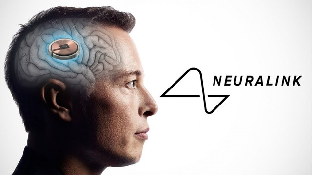Người đầu tiên được
cấy chip não Neuralink đã hồi phục, còn được bổ sung thêm
''siêu năng lực'' mới
